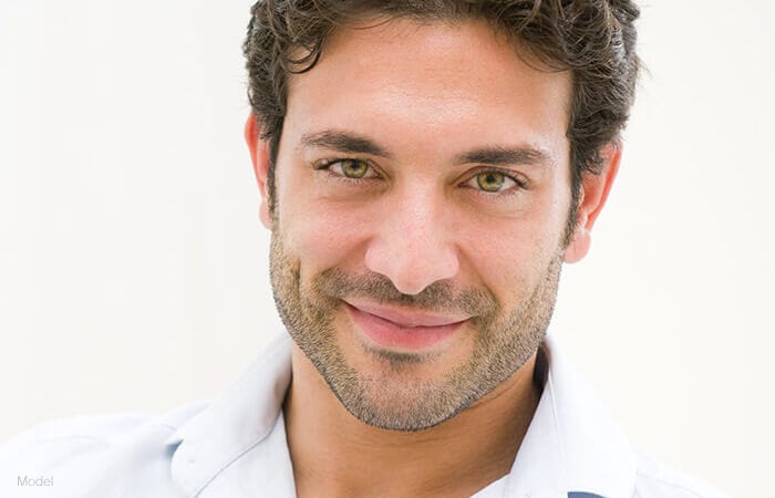 male model wearing white polo shirt facing forward and smiling for endoscopic browlift